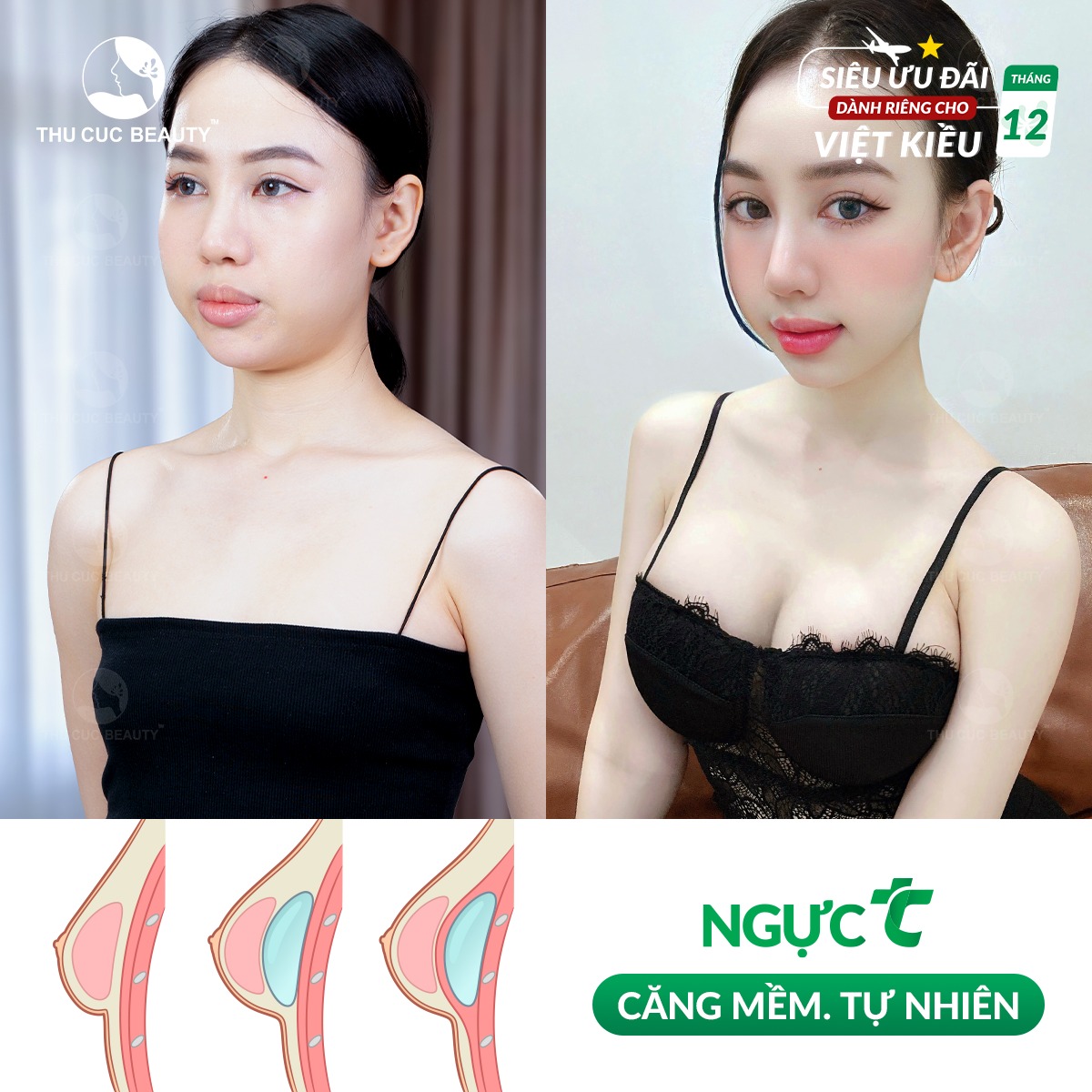 Thẩm mỹ vóc dáng